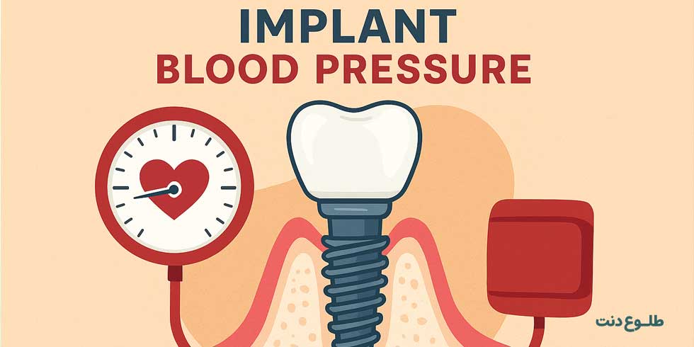 ایمپلنت و فشار خون