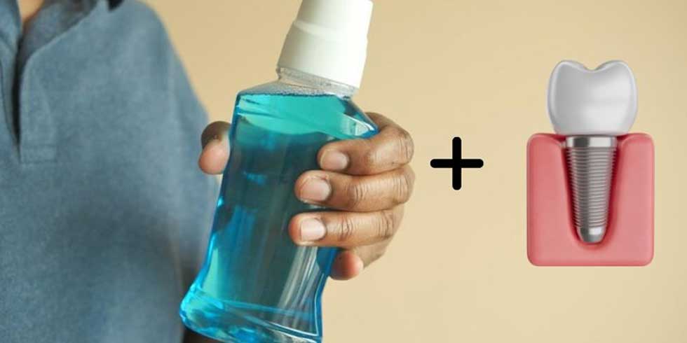 دهانشویه مخصوص ایمپلنت